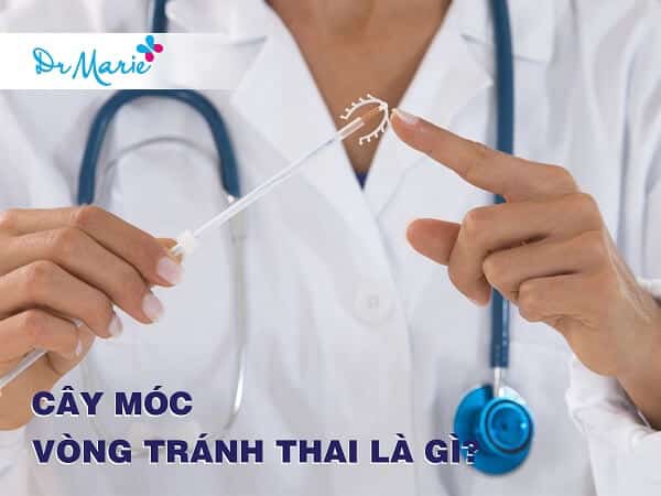 Lợi ích và rủi ro khi sử dụng vòng tránh thai