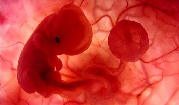 Siêu âm 3 tháng đầu thai kỳ là một trong những xét nghiệm đặc biệt quan trọng
