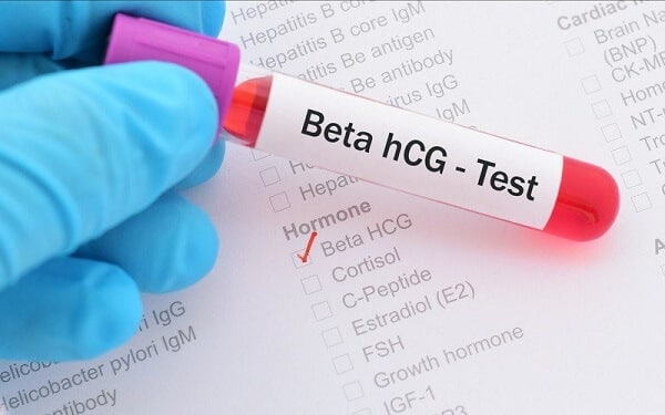 Xét nghiệm HCG - Một trong các xét nghiệm cần làm khi mang thai rất quan trọng