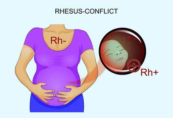 Xét nghiệm kháng thể Rh đặc biệt quan trọng khi mang thai